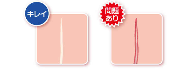 キレイ・問題あり