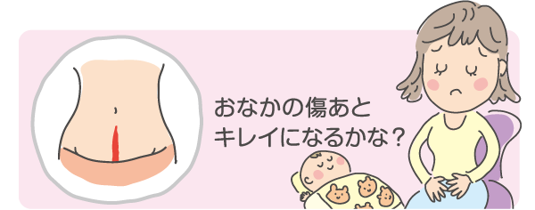 おなかの傷あとキレイになるかな？