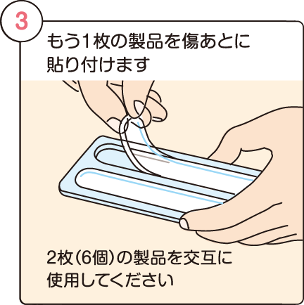 もう1枚の製品を傷あとに貼
り付けて使用します