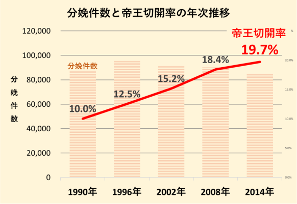 帝王切開率の年次推移
