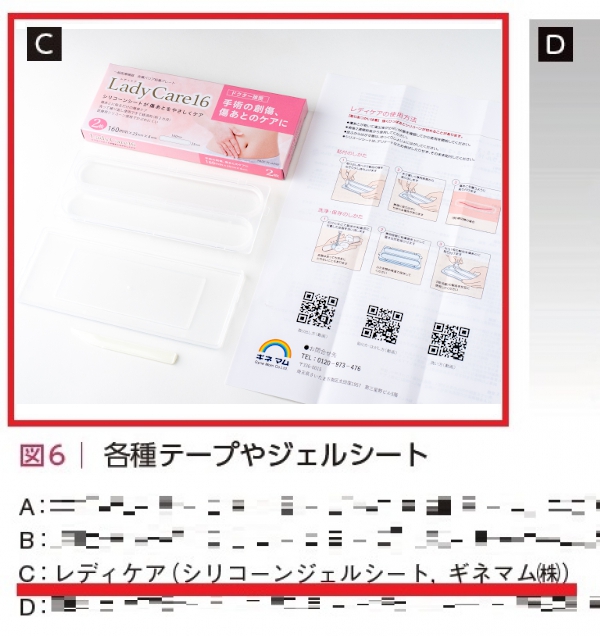 形成外科小川教授の著書での紹介です。